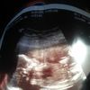 chelsie19943482